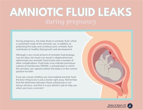 pregnant leaking fluid|Leaking Amniotic Fluid: Signs, Causes, and。